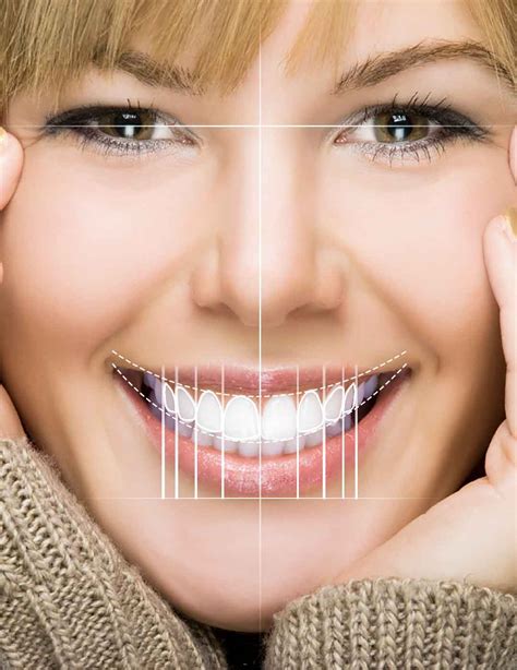 Anatomy Of A Smile Smile Esthetics 101 42 Off