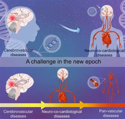 Science Bulletin｜从脑血管疾病到脑心共患病：一个新时代的挑战腾讯新闻