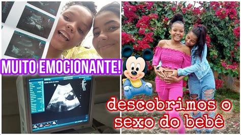 DESCOBRINDO O SEXO DO BEBÊ Ultrassonografia Obstétrica Vlog de