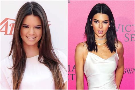 Kardashians Before And After Plastic Surgery | Her Beauty | Page 2
