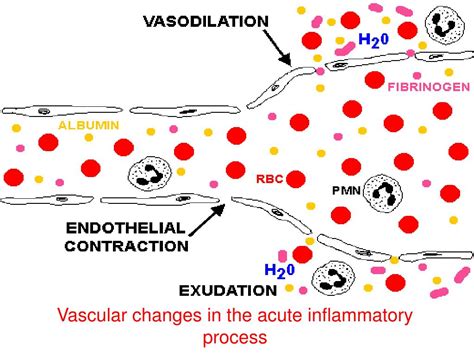 Ppt Inflammation Powerpoint Presentation Free Download Id687153