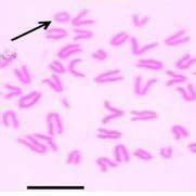 A E Representatives Of Bone Marrow Metaphase Chromosome Spreads Of