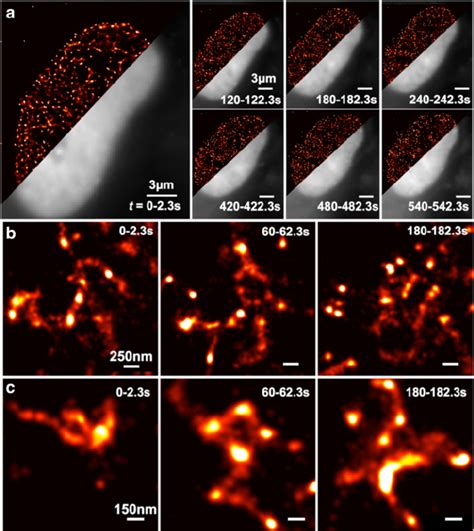 Super Resolution Live Cell Imaging Of The Dynamics Of Hp In A Hues