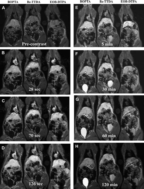 Comparison Of Gdbzttda Gdeobdtpa And Gdbopta For Dynamic Mr