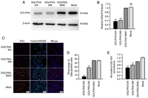 Knockdown Of Golph Inhibits The Proliferation Of Gbc Cells A And B