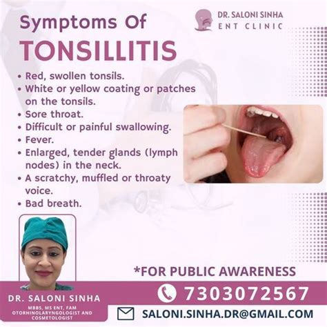 Symptoms of Tonsillitis | Swollen tonsils