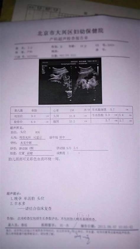 產檢b超單里的套路你懂多少 每日頭條