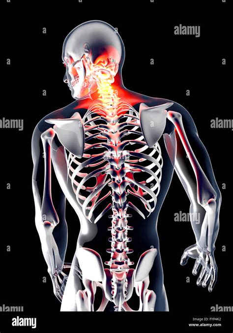 Anatomy - Back Pain Stock Photo - Alamy