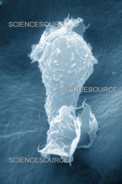 Photograph Human Macrophage SEM Science Source Images