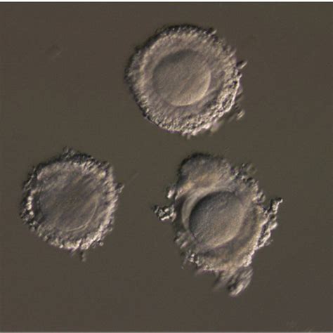 Oocytes after in vitro maturation for 24 h. A; matured oocyte, B ...