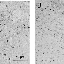 Thalamic and epithalamic regions assessed for Fos-protein expression.... | Download Scientific ...