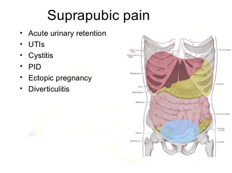 Diagnosis And Management Of Acute Abdominalpain