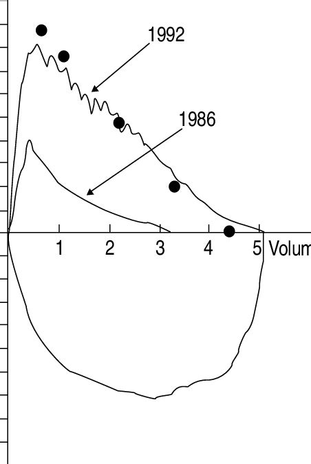 Maximal Expiratory Flow Volume Curves In May 1986 And May 1992 In Download Scientific Diagram