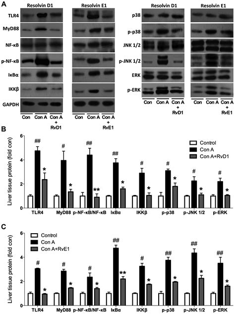 Resolvin D1 And E1 Alleviate The Progress Of Hepatitis Toward Liver