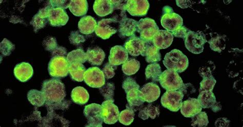 Brain Eating Amoeba Found In Another Louisiana Water System Cbs News