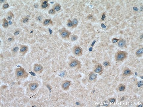 CRMP2 antibody (14686-1-AP) | Proteintech 