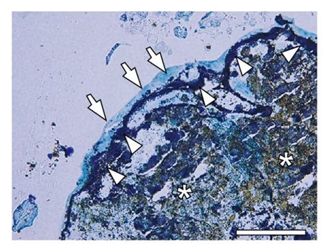 A Von Kossa Staining And Counterstaining With Methylene Blue Most