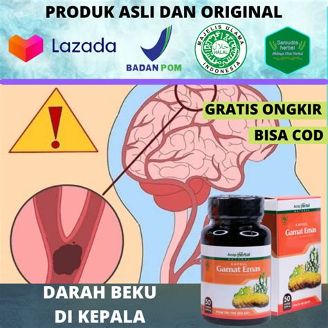 Obat Darah Beku Di Kepala Mengencerkan Darah Beku Akibat Jatuh