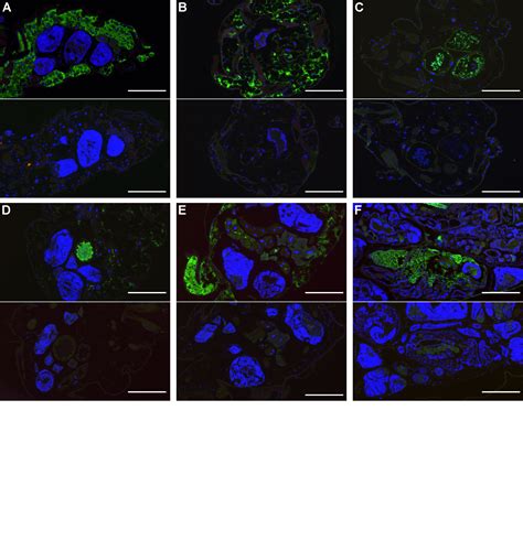 Pdf Dickeya Dadantii A Plant Pathogenic Bacterium Producing Cyt Like Entomotoxins Causes