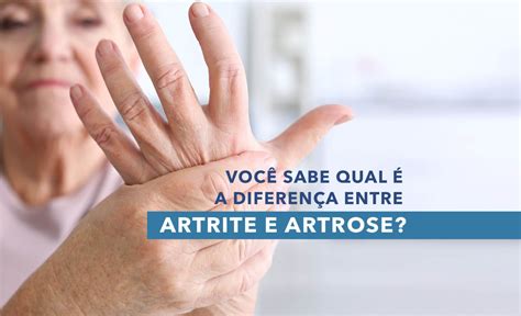 Médico Que Cuida De Artrite E Artrose - Artrite x Artrose - Saiba a diferença entre as doenças, seus sintomas ...