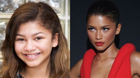 Did Zendaya Receive a Nose Job? The Untold Truth!