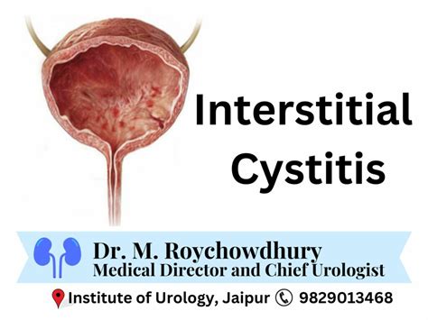 Interstitial Cystitis: Symptoms, Causes, Diagnosis, and Management