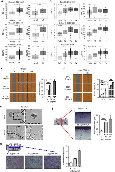 Collagen I Expression Correlates With Increasing Tumor Stage And