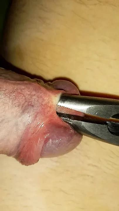 Beads String Cock Sounding Into Bladder Gay Amateur Porn Feat Dmitri3372 XHamster