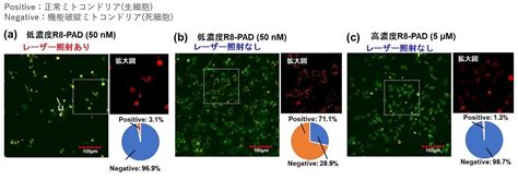 光濃縮を利用して低濃度の薬剤を細胞内に導入する技術を開発：医療技術ニュース Monoist