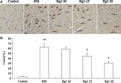 Effects Of Ginsenoside Rg Treatment On Cardiomyocytes Apoptosis A