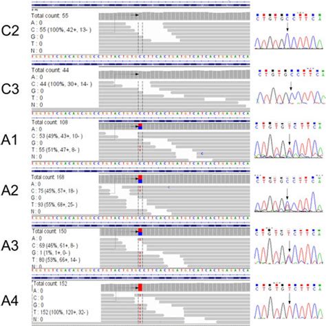 Example Of Validation By Sangers Sequencing Of A Snv Specific To