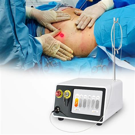 Best Selling Dual Laser 1470nm 980nm Lipolysis Liposuction Endolaser