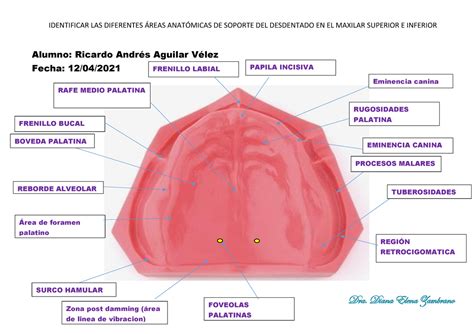 Tarea 1 convertido resumen de reparos anatómicos protésicos