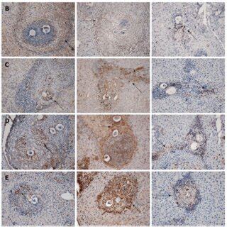 Representative images of immunostaining for osteopontin α SMA and