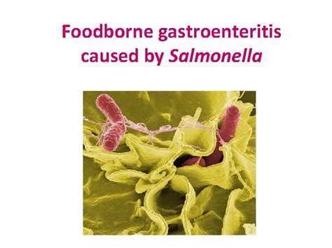 Foodborne Gastroenteritis Caused By Salmonella Food Poisoning By