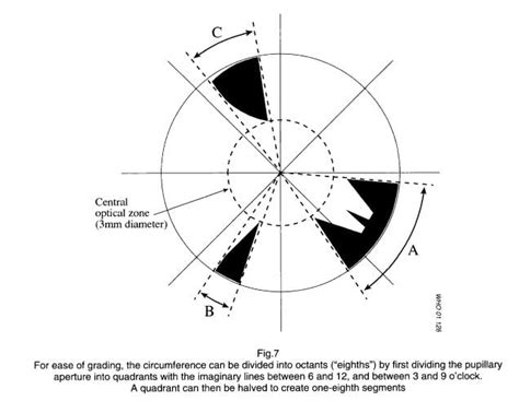 Grading In Ophthalmology Eye Health Nepal