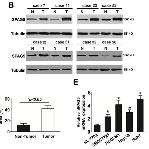 Relative Spag Expression In Hcc Tissues And Hcc Cells A Relative