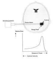 Focal Radiation (Bragg Peak) Most radiation energy delivered from... | Download Scientific Diagram