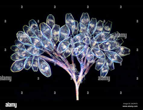 Vorticella Protozoa Differential Interference Contrast DIC Light