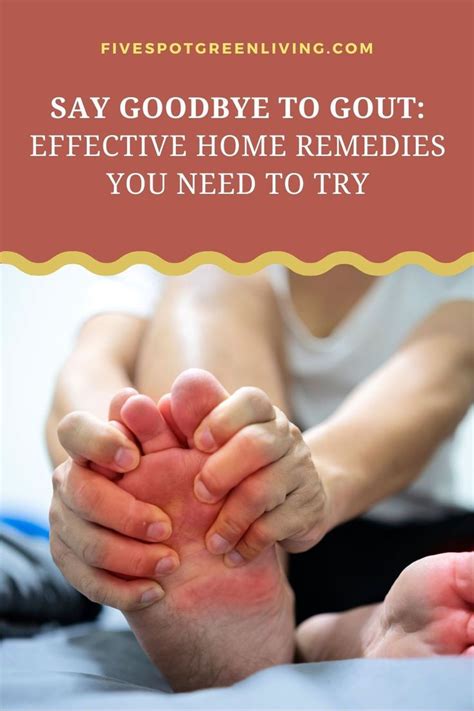 Natural Home Remedies To Treat Gout Artofit