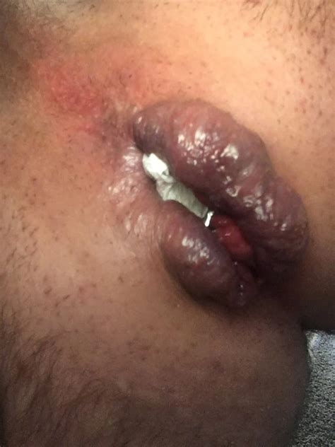 Tunnel Plug Nude Pics XHamster