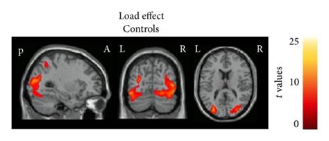 Brain Regions Showing Significant Activation Colour Coded With