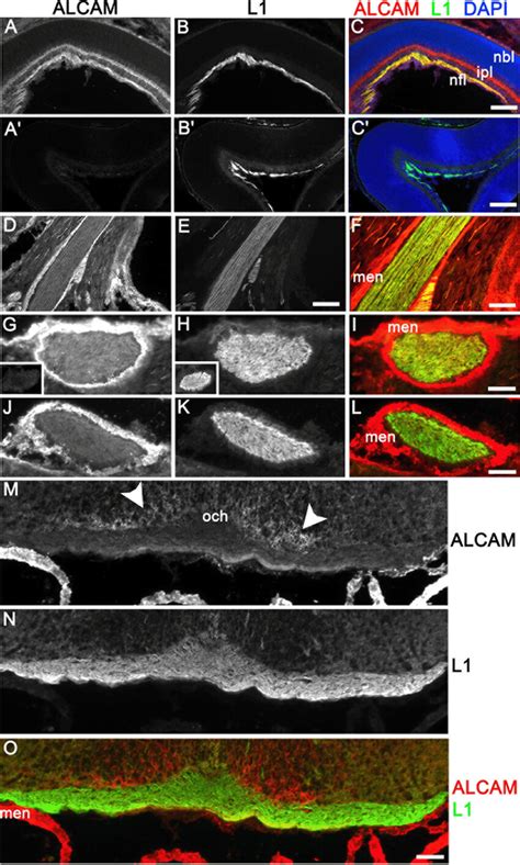 Alcam And L Colocalize On Rgc Axons Proximal But Not Distal To The