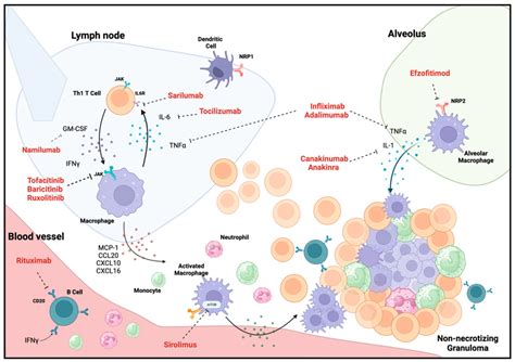 Schematic For Non Necrotizing Granuloma Formation In Pulmonary