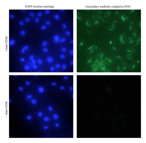 Adipocyte Cell Line Expresses Cd Receptor Sw Adipocytes Were