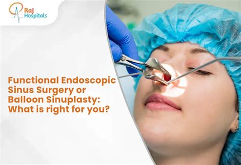 Functional Endoscopic Sinus Surgery Or Balloon Sinuplasty What Is