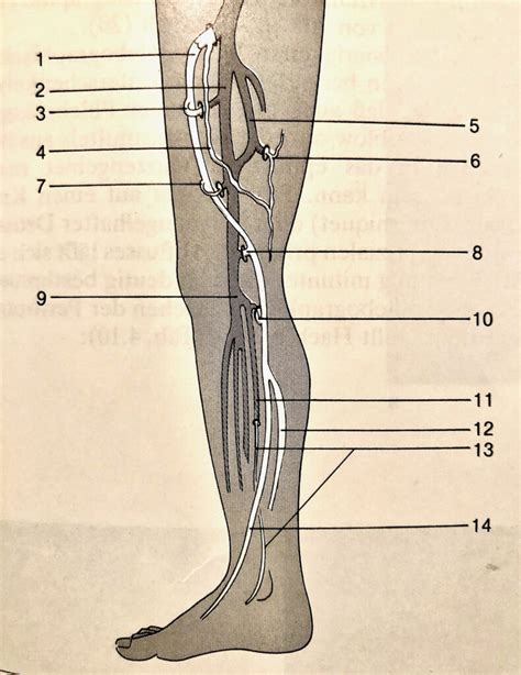 Saphenion Therapie Von Perforanzkrampfadern Mit Venenkleber