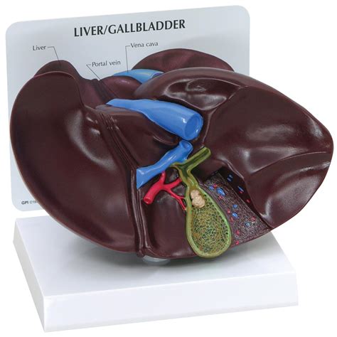 Liver Gallbladder Model With Gallstones 1019551 3300 Anatomical