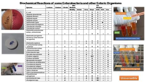 Common Bacteria Biochemical Test Demonstration: Introduction, Common