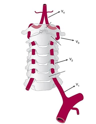 Ramas De La Arteria Vertebral